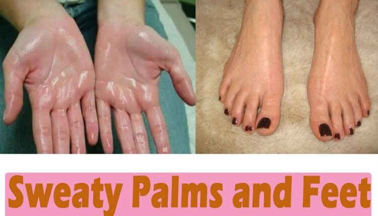 Sweaty Palms And Hands : Do feet and hands sweat excessively? Here is the solution to your problem.
