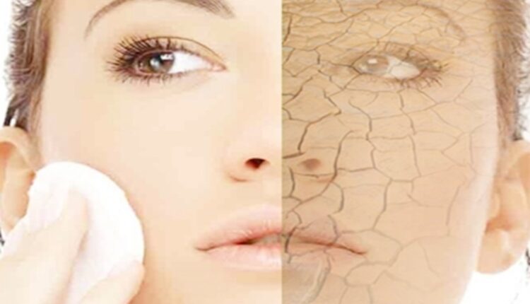 Skin Problems In Winter : Treat skin problems in winter by following these precautions